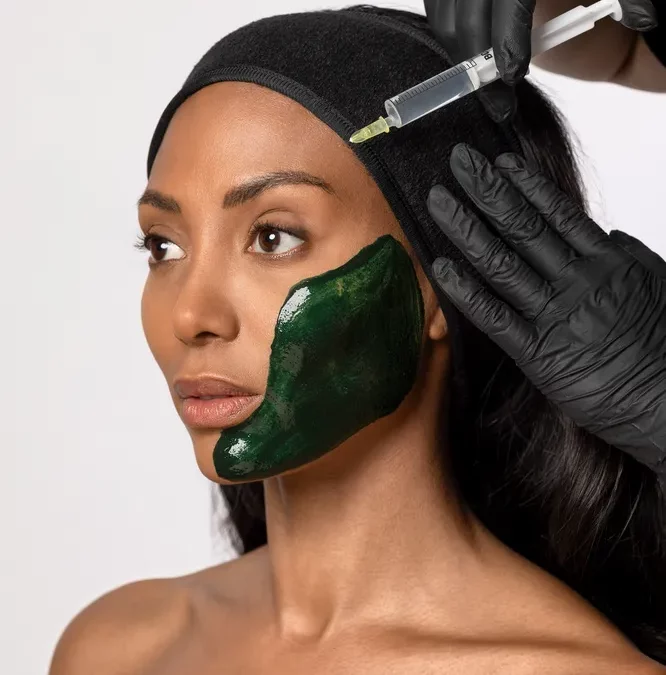 MESOTHERAPY & BIO PEELING